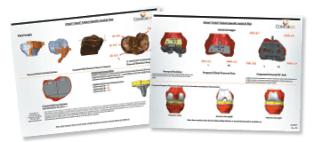 conforMIS brochure