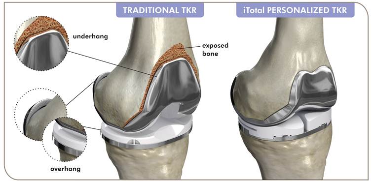 knee diagram