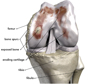 knee_smaller